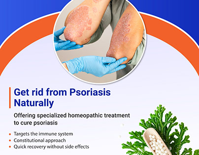 Psoriatic Arthritis Treatment | Psoriatic Scalp