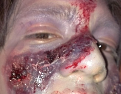Zombie Effects Makeup