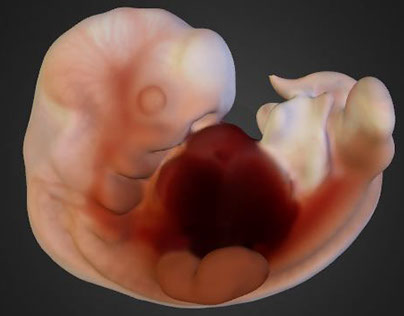 3D Reconstruction of Human Embryo