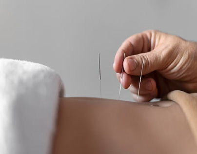 Acupuncture For Drug Addiction