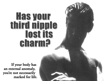 Has your third nipple lost its charm?
