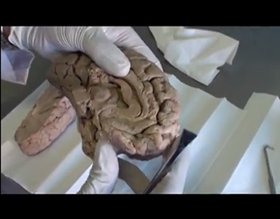 Human Brain Papez Circuit Demonstration–Sanjoy Sanyal