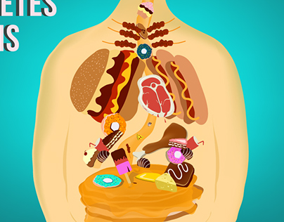 Diabetic Anatomy Illustration
