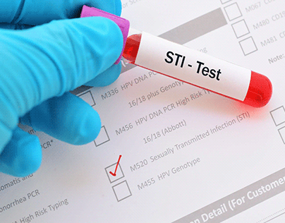 STI Test in Dubai