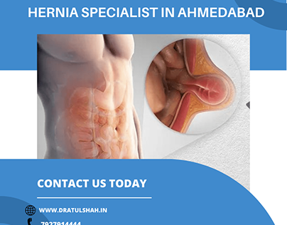 Hernia Specialist in Ahmedabad