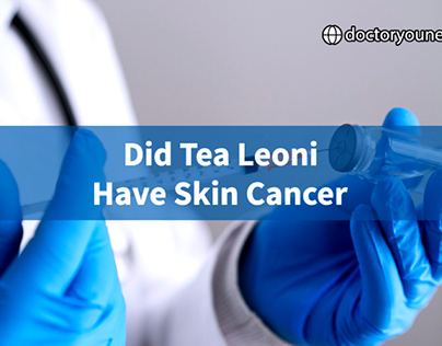 Did Tea Leoni Have Skin Cancer