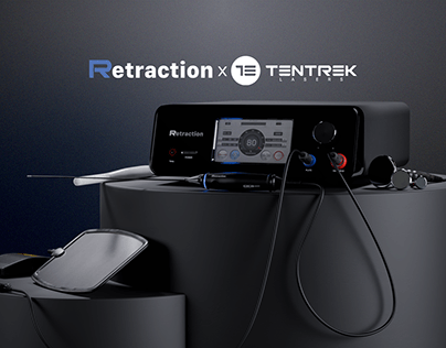 Retraction Tech by Tentrek Lasers