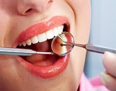 How can I get the best dental bridge procedure?