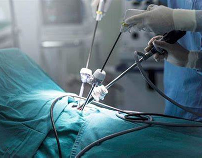 What Are the Qualities of a Top Laparoscopy Surgeon?