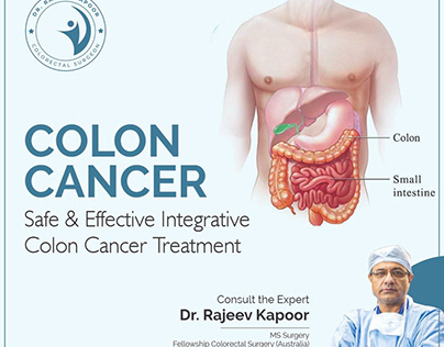 Trusted Colon Cancer Treatment with Dr. Rajeev Kapoor