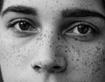 The girl with FRECKLES