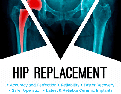 Dr Anoop Jhurani is Hip Replacement Doctor in Jaipur