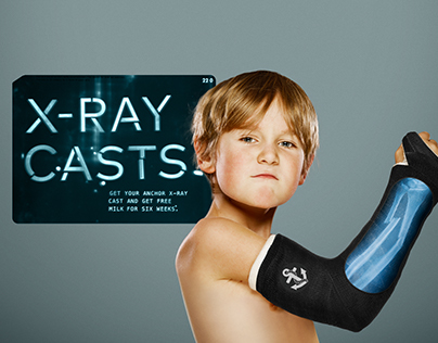 X-Ray Casts