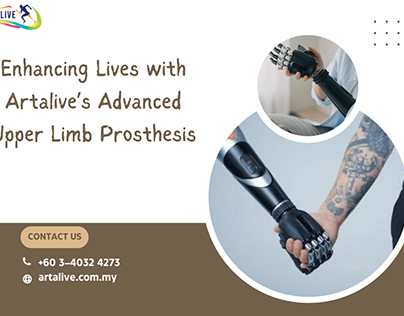 Enhancing Lives with Artalive’s Upper Limb Prosthetics