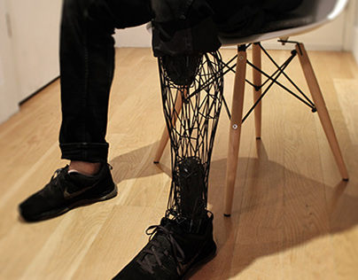 Exo Prosthetic Leg