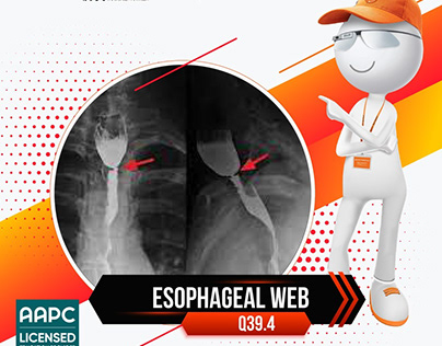 ICD-10 code Q39. 4 for Esophageal web
