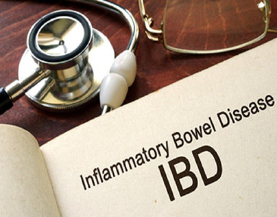 Study Reveals IBD Symptoms Improved for Patients