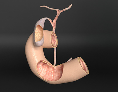 3D model gallbladder