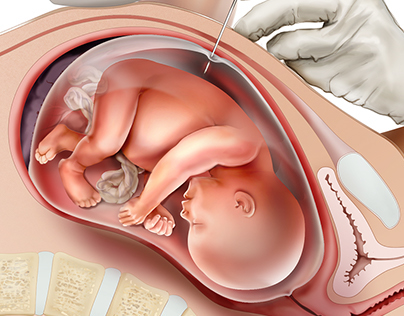 Fetal Testing Series