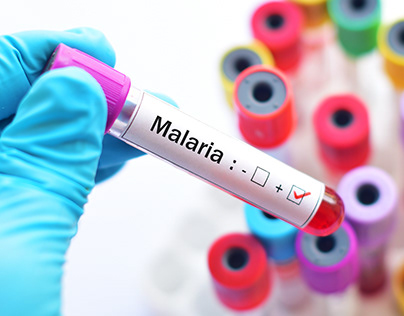 How is malaria treated and prevented?
