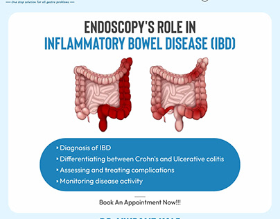 Endoscopy's Role in IBD- Dr. Vikrant Kale