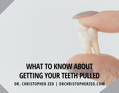 What to Know About Getting Your Teeth Pulled