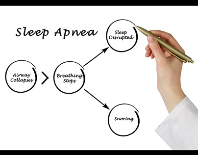 Sleep Apnea 2022 - Flinders Discount Chemist