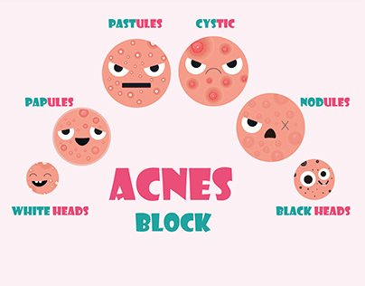 interactive infographic acnes block project