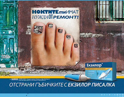 Excilor - treatment for fungal nail infection