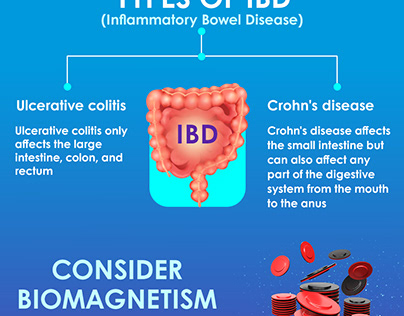Types of IBD