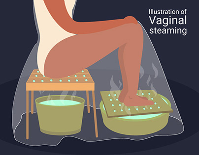 Visualizing the Process of Vaginal Steaming