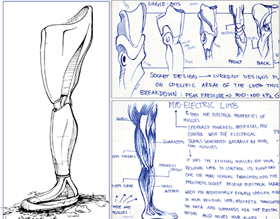 Prosthetic Leg Design Experiment