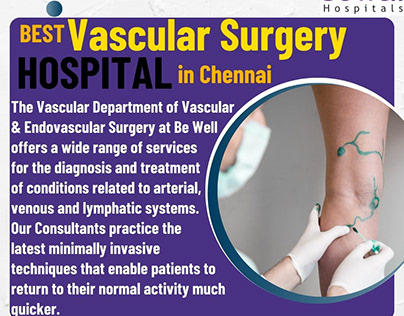Best Vascular Surgery Hospital in Chennai