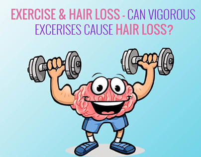 Exercise & Hair Loss