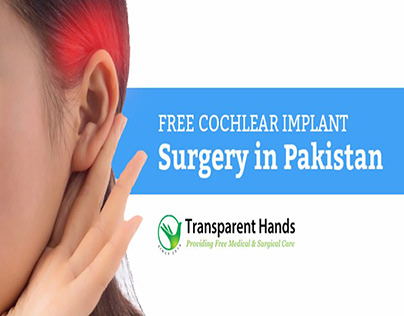 Free Cochlear Implant Surgery