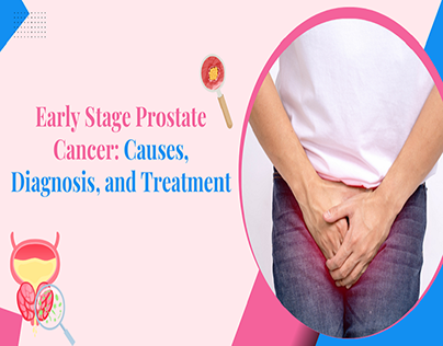 Early Stage Prostate Cancer: Causes & Diagnosis