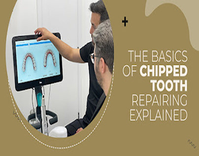 The basics of chipped tooth repairing explained