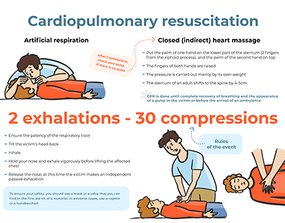 Poster how to Do CPR: Steps for Adults
