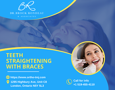 Teeth Straightening with Braces - Dr. Brock Rondeau