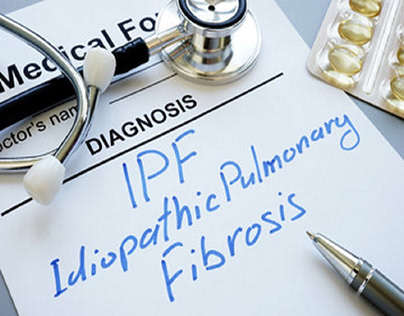 IPF - A Condition Involving Lung Scarring