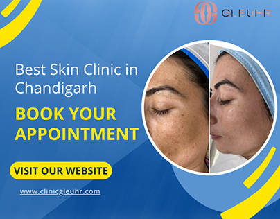 Best Skin Clinic in Chandigarh