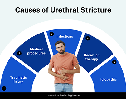 Causes of Urethral Stricture