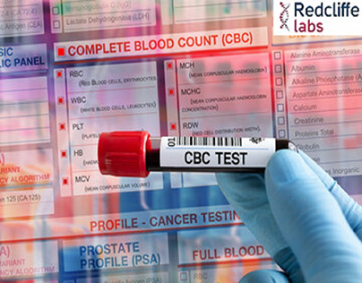 CBC Test - Complete Blood Count - Redcliffe Labs