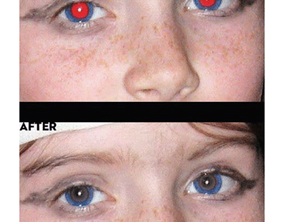 Red Eye Removal