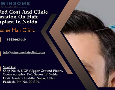 Clinic Information On Hair Transplant In Noida