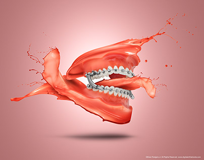 Orthodontic Splash