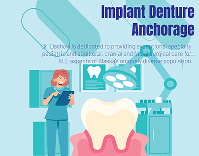 Implant Denture Anchorage