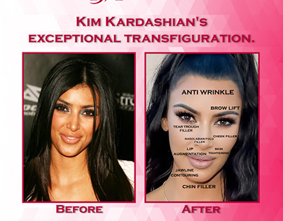 Kim Kardashian's Transformation Post for DMM