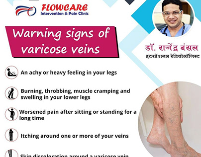 varicose veins treatment in Jaipur