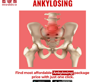 Find The Ankylosing doctors in Mumbai - Meddco